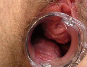101620_tattooed_teen_with_hairy_gash_panty_stuffing_speculum_cervix_view